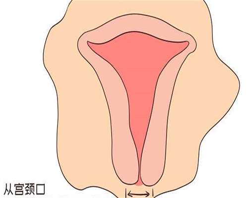 试管代怀